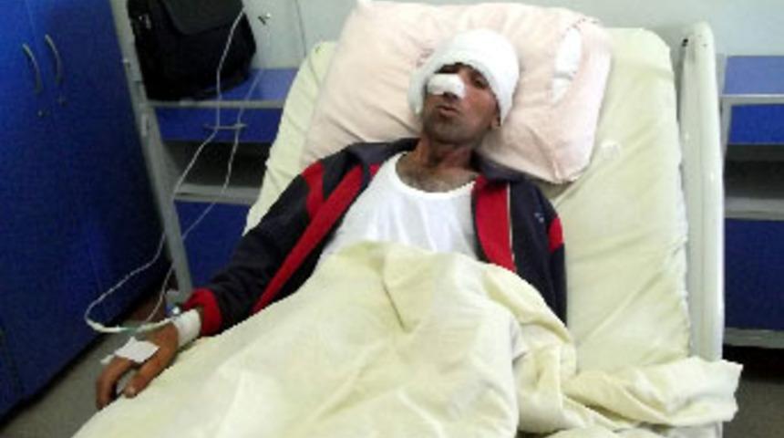 Ayıdan &ouml;l&uuml; numarası yaparak kurtuldu