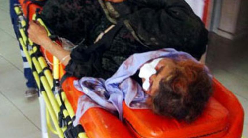 &Uuml;zerine kuma getirdiği eşini d&ouml;vd&uuml;