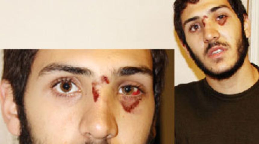 Metrob&uuml;ste polis dehşeti