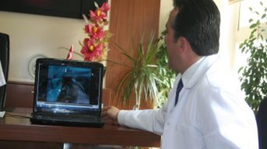 Nevşehir Devlet Hastanesi'nde hastayı uyutmadan beyin ameliyatı yapıldı