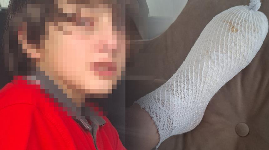 AVM'den alınan oyuncak k&uuml;&ccedil;&uuml;k Furkan'ın elinde patladı: "Dehşet verici bir sesle seslendi"