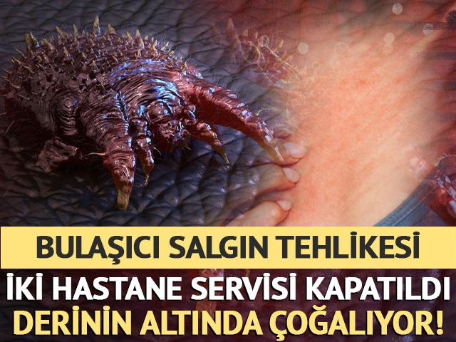 En bulaşıcı salgın! İki hastane servisi kapatıldı