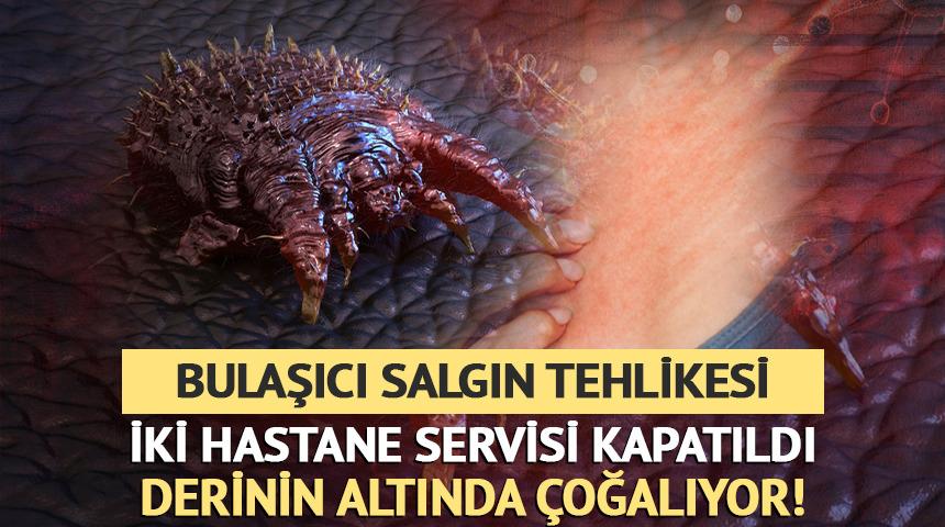 En bulaşıcı salgın! İki hastane servisi kapatıldı