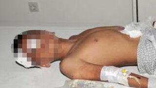 Elinde bomba patladı