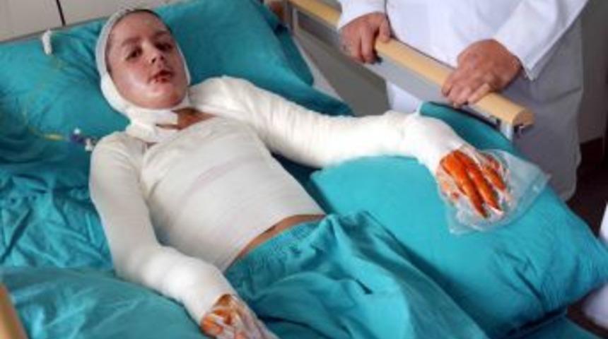 Libya'daki savaşta v&uuml;cudu yanan &ccedil;ocuk Samsun'da tedavi ediliyor