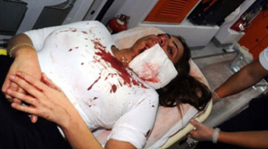 Boşandığı eşinin y&uuml;z&uuml;n&uuml; kesti