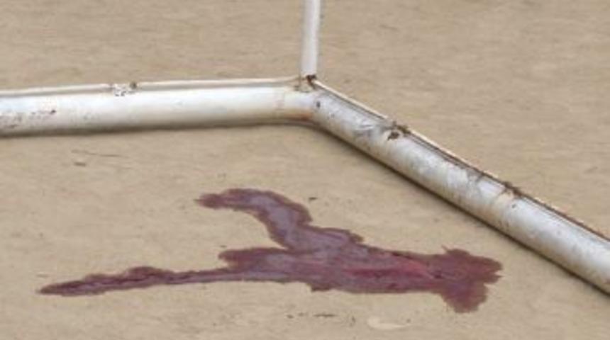 Başına kale direği d&uuml;şen &ccedil;ocuk hayatını kaybetti