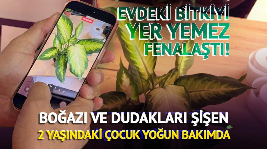 Boğazı ve dudakları şişen 2 yaşındaki &ccedil;ocuk yoğun bakımda