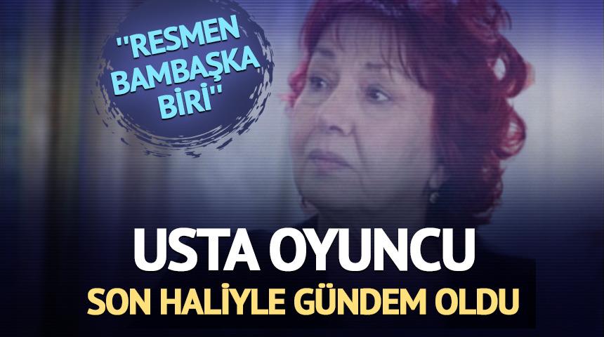 Son hali g&uuml;ndem oldu! ''Resmen bambaşka biri''  