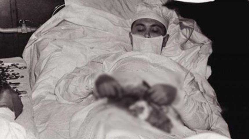 Doktor kendi ameliyatını yapmak zorunda kaldı! Apandisitini aynaya bakarak aldı
