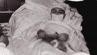 Doktor kendi ameliyatını yapmak zorunda kaldı! Apandisitini aynaya bakarak aldı