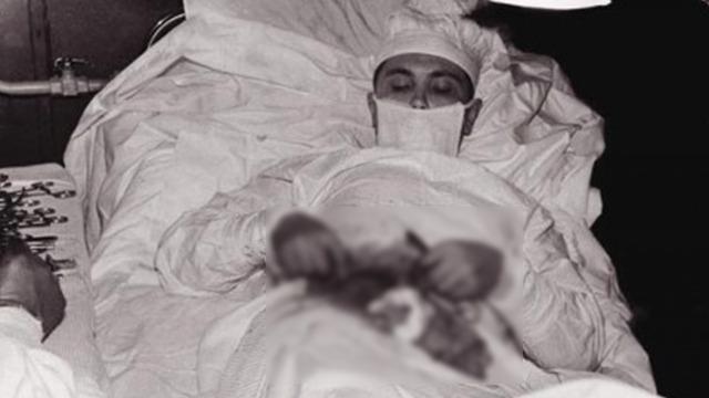 Doktor kendi ameliyatını yapmak zorunda kaldı! Apandisitini aynaya bakarak aldı