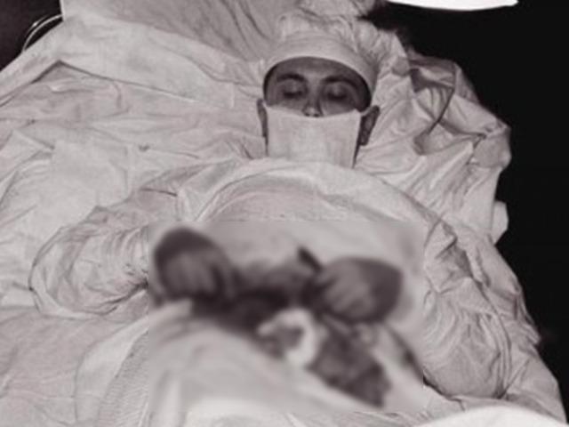 Doktor kendi ameliyatını yapmak zorunda kaldı! Apandisitini aynaya bakarak aldı