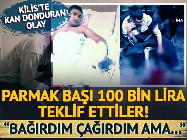 Elini makineye kaptırdı: Parmak başı 100 bin teklif ettiler! "Bağırdım, &ccedil;ağırdım dalga ge&ccedil;tiğimi sandılar..."