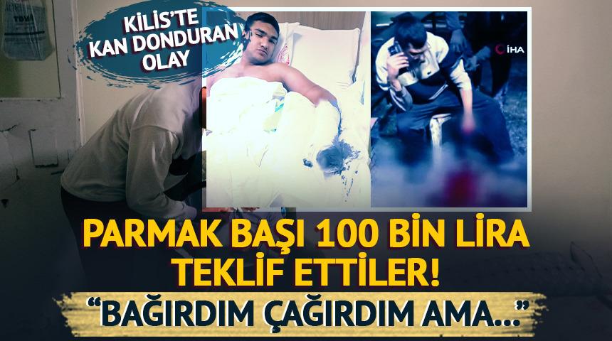 Elini makineye kaptırdı: Parmak başı 100 bin teklif ettiler! "Bağırdım, &ccedil;ağırdım dalga ge&ccedil;tiğimi sandılar..."