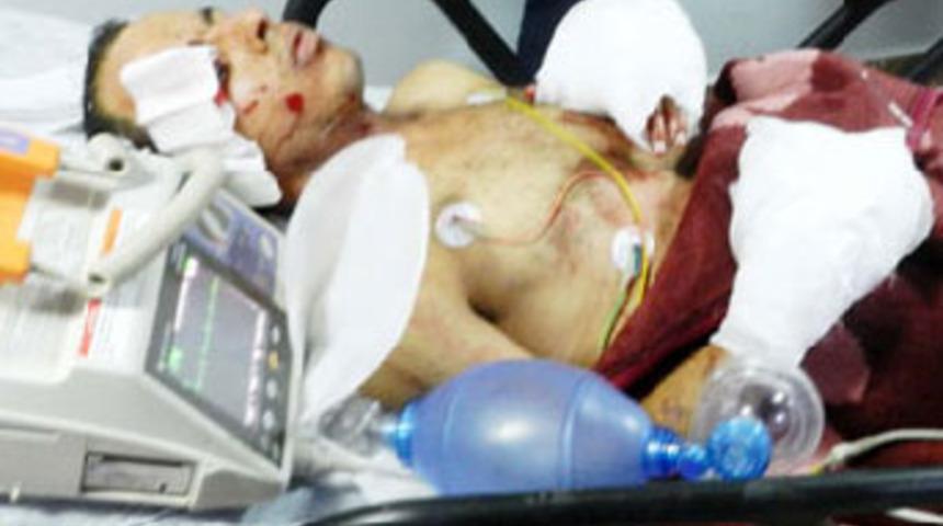 Okula atmak istediği bomba, elinde patladı