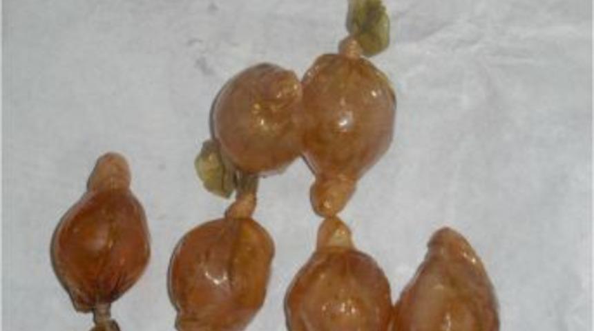 Bağırsakları d&uuml;ğ&uuml;mlenince &ouml;l&uuml;mden d&ouml;nd&uuml;