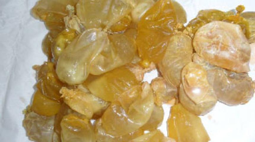 Prezervatif içinde uyuşturucu sevkiyatı