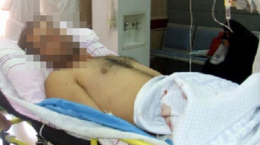 Matkapla penisini koparttı