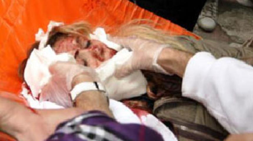 Eski eşe falçatalı saldırı