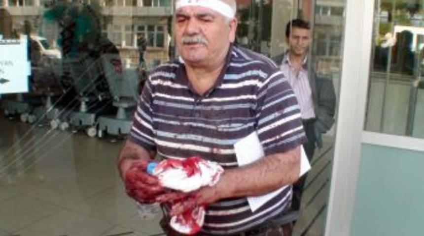 Sadece acemi kasaplar kendini kesmedi