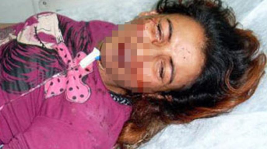 Eve d&ouml;nmeyen eşini bu hale getirdi