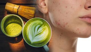 G&uuml;nde 4 bardak matcha i&ccedil;iyordu! Y&uuml;z&uuml;n&uuml; g&ouml;renler inanamadı