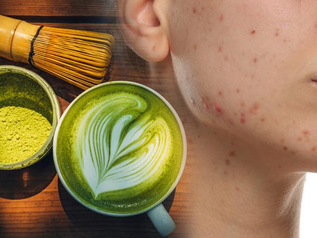 G&uuml;nde 4 bardak matcha i&ccedil;iyordu! V&uuml;cudu alarm verdi: Y&uuml;z&uuml;n&uuml; g&ouml;renler inanamadı