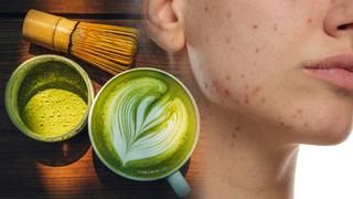 Günde 4 bardak matcha içiyordu! Vücudu alarm verdi: Yüzünü görenler inanamadı