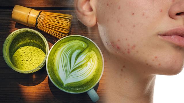 Günde 4 bardak matcha içiyordu! Vücudu alarm verdi: Yüzünü görenler inanamadı