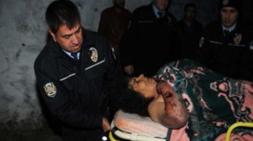 Karaoğlan isimli rottweiler cinsi k&ouml;pek sahibini hastanelik etti