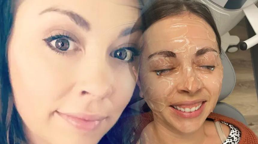 20 yıl boyunca makyajla uyudu hayatı kabusa d&ouml;nd&uuml;! G&ouml;z kapağı g&ouml;z k&uuml;resine yapıştı