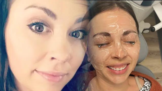 20 yıl boyunca makyajla uyudu hayatı kabusa döndü! Göz kapağı göz küresine yapıştı