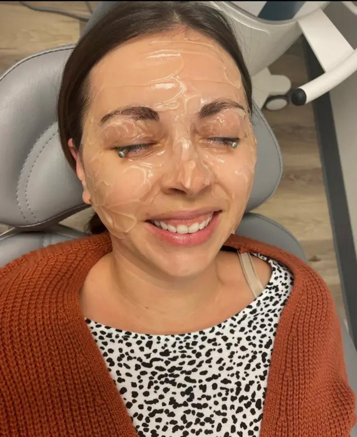 20 yıl boyunca makyajla uyudu hayatı kabusa döndü! Göz kapağı göz küresine yapıştı 2