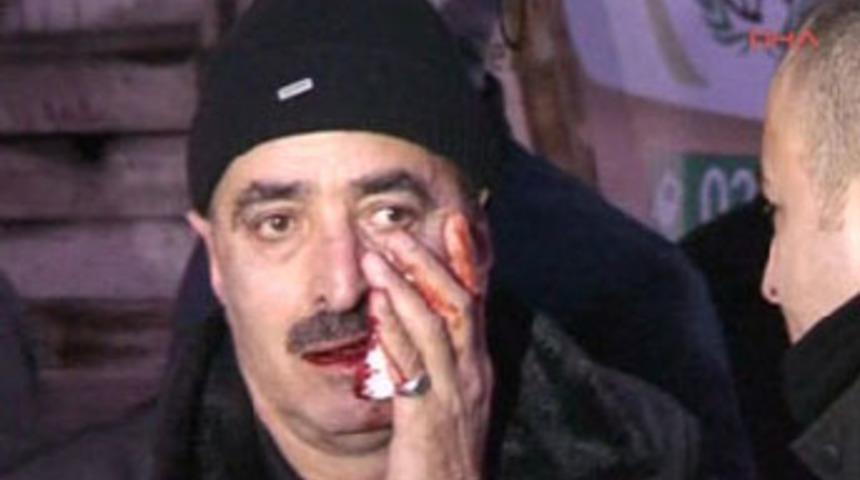 "Kadına vurma" diyen adamı bı&ccedil;akladı