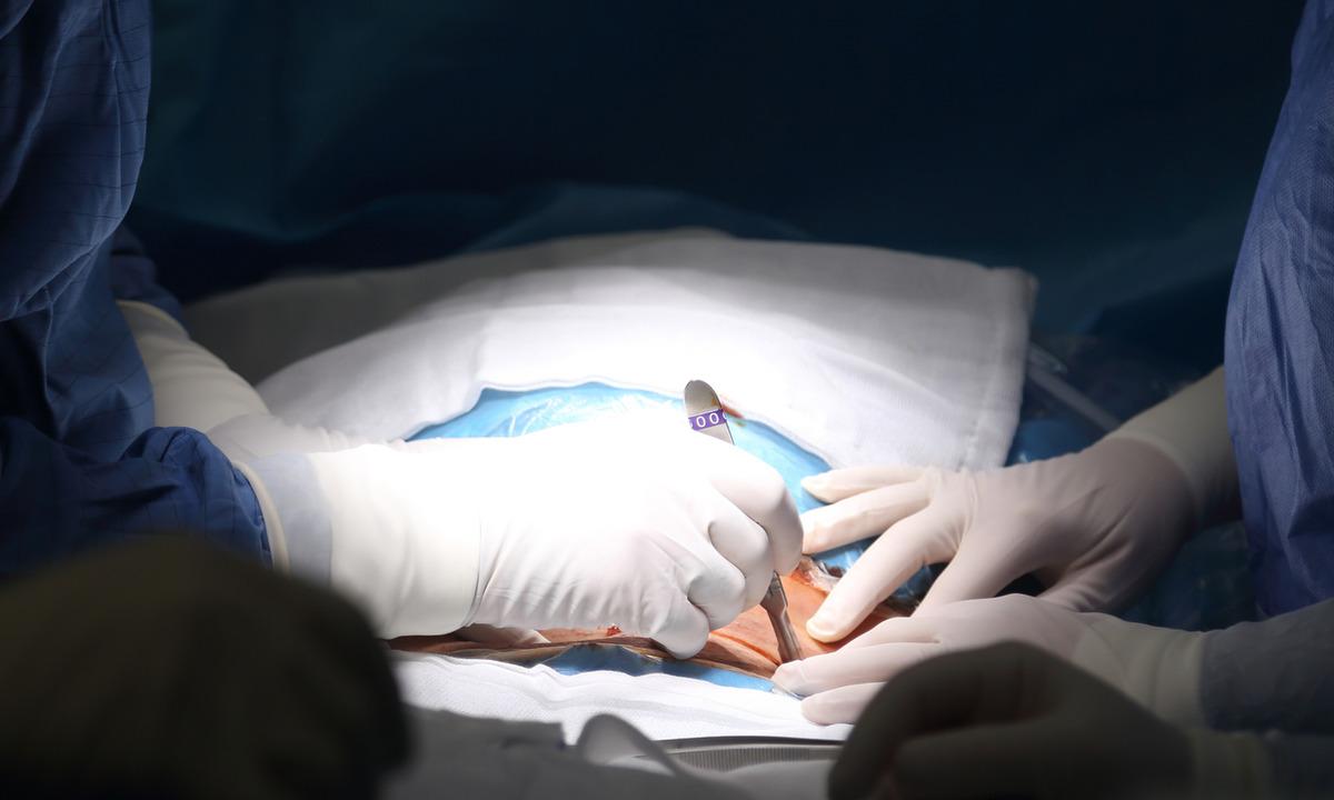 Kilo vermek için mide ameliyatı oldu: Operasyondan sonra 32 kilo aldı 2