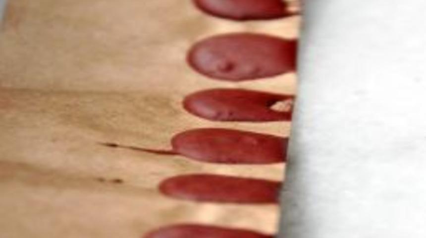 Çatapat yutan çocuğa karaciğer nakli yapıldı