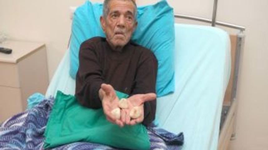 Mesanesinden yumurta b&uuml;y&uuml;kl&uuml;ğ&uuml;nde &uuml;&ccedil; taş &ccedil;ıktı