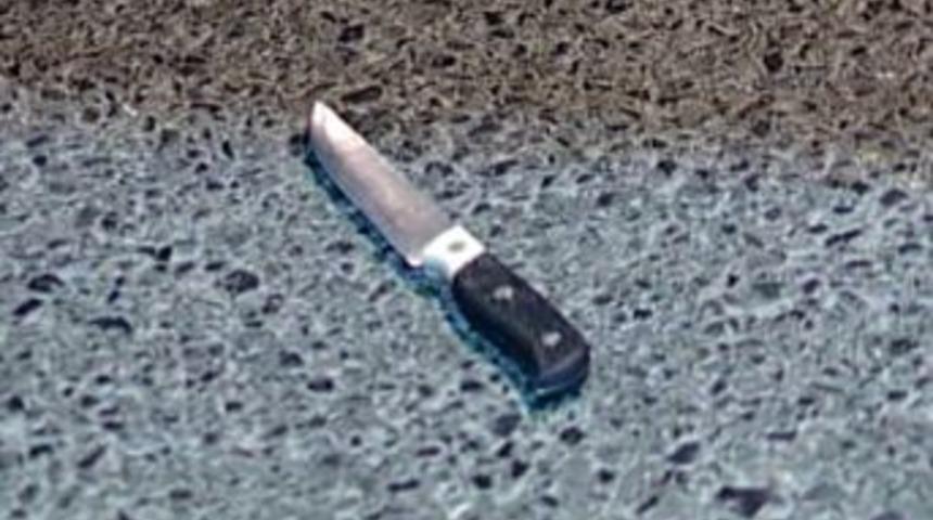 Bı&ccedil;aklı kavgada yaralanan iki kardeş hayatını kaybetti