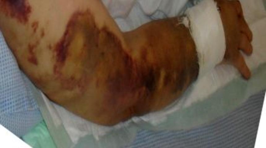 Karısının iki ayağını kırdı, 10 g&uuml;n evde sakladı, jandarma serbest bıraktı