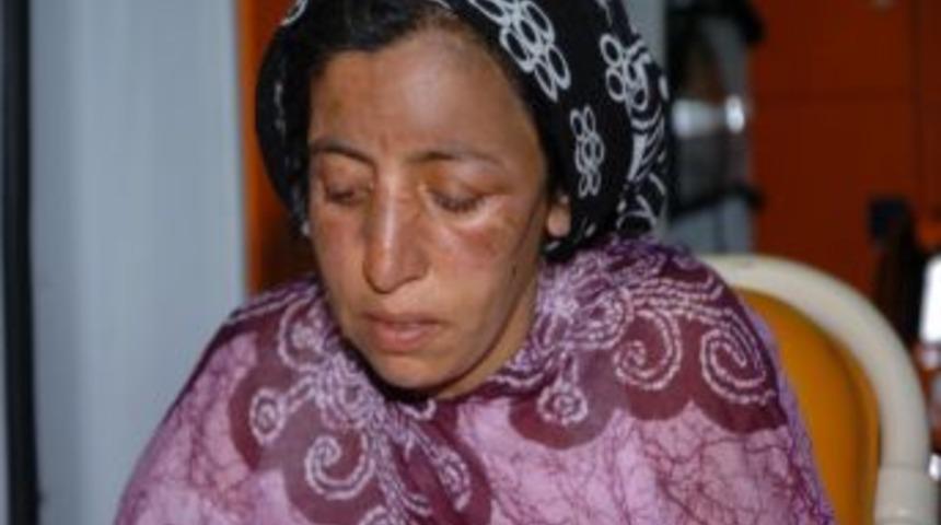 &Ccedil;adır yangınında yaralanan anne ile kızı Diyarbakır'a sevk edildi