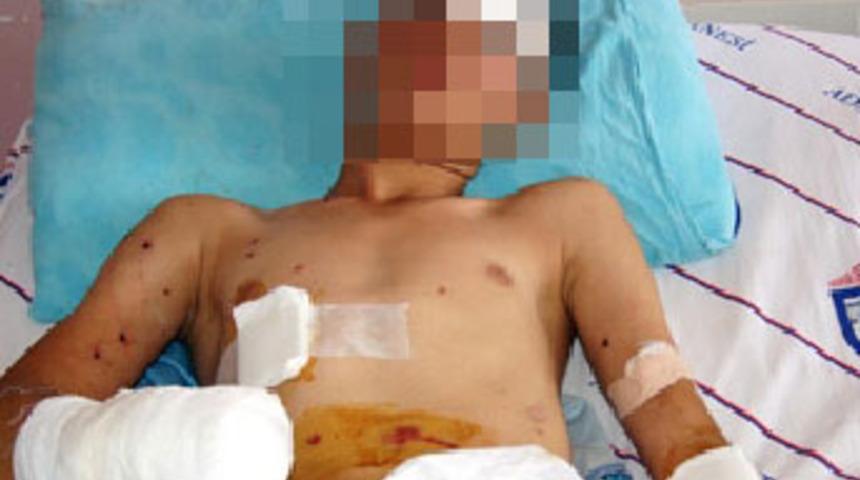 Polise atmak istediği bomba elinde patladı