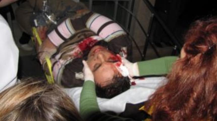 Karasu'da trafik kazası: 1 yaralı