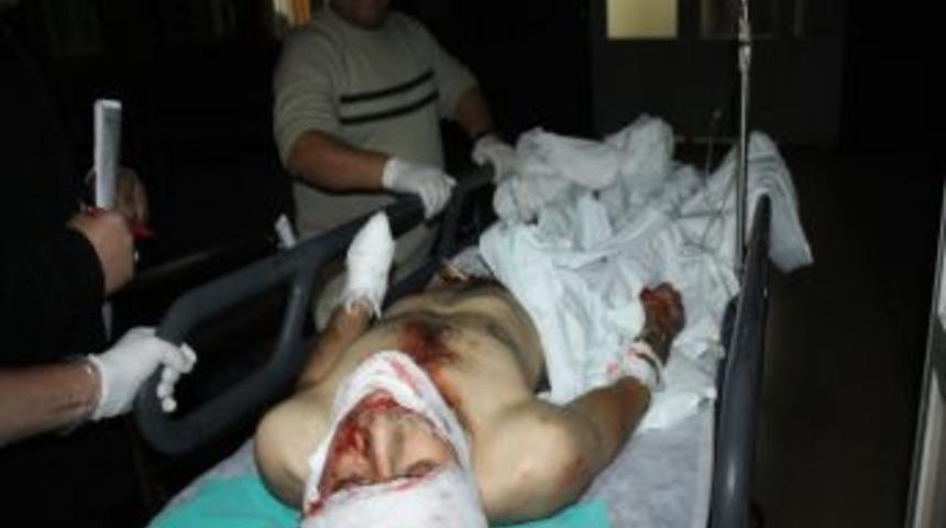 Polise atmak istediği bomba patlayınca eli koptu