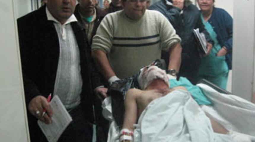 Polise atacakları bomba ellerinde patladı