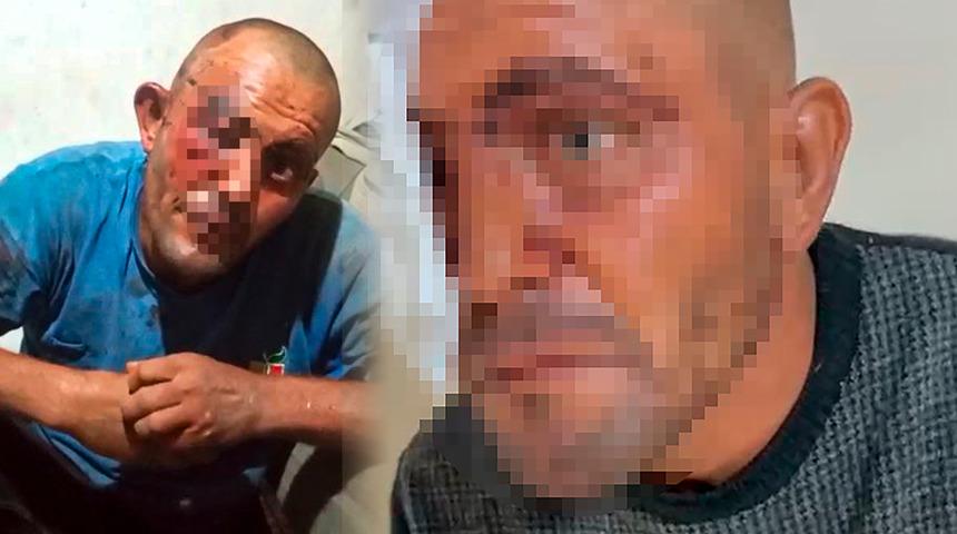 Sosyal medyadaki videoları ile tanınıyor! Feci şekilde darbedildi