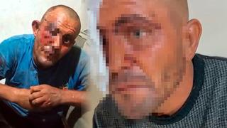 Sosyal medyadaki videoları ile tanınıyor! Feci şekilde darbedildi