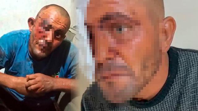 Sosyal medyadaki videoları ile tanınıyor! Feci şekilde darbedildi