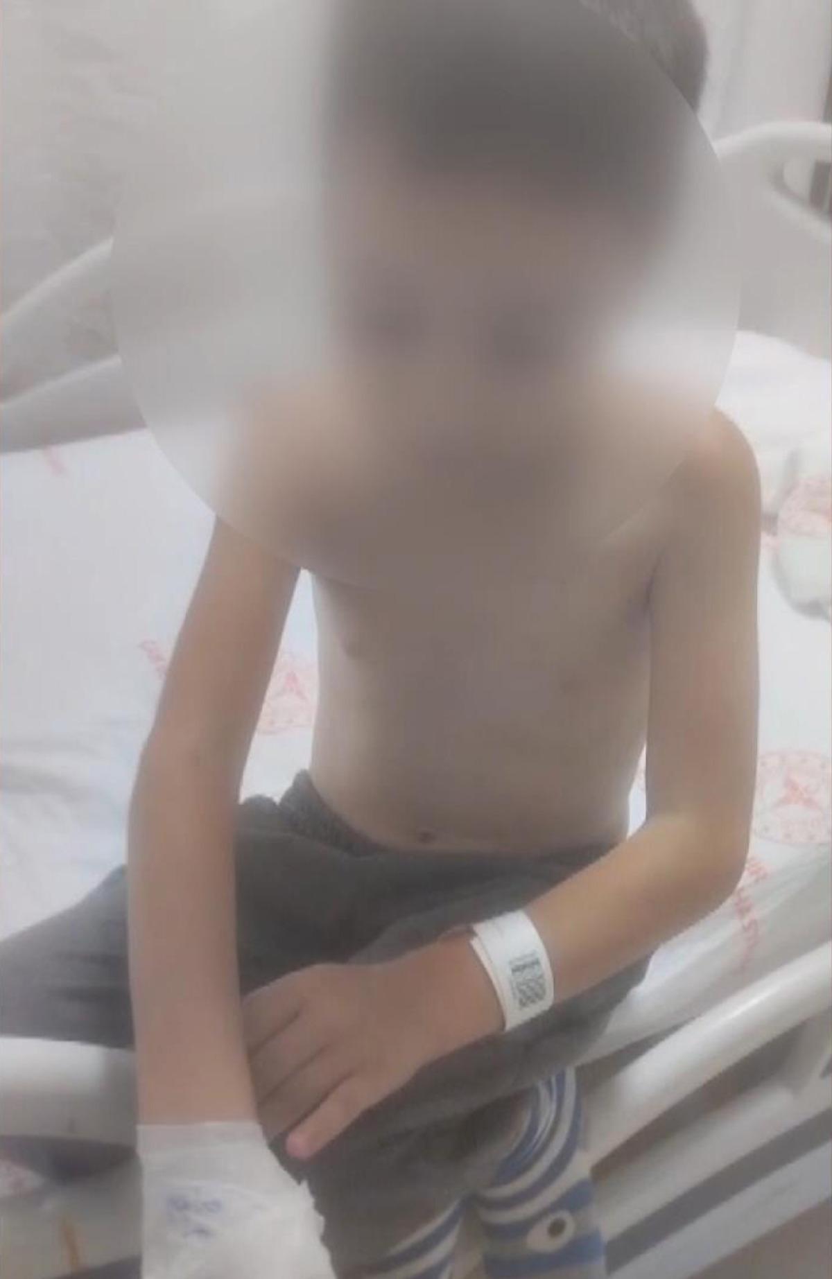 12 yaşındaki &ccedil;ocuğa kolonya d&ouml;k&uuml;p ateşe verdiler! 1