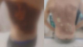 12 yaşındaki çocuğa kolonya döküp ateşe verdiler!